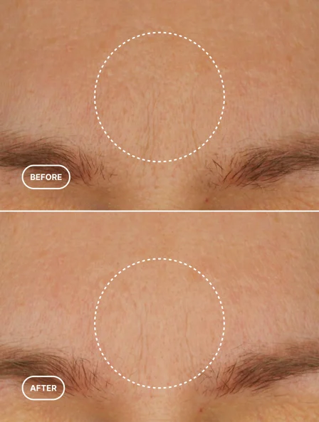 THE PHYTO-RETINOL | Evening Ritual.
