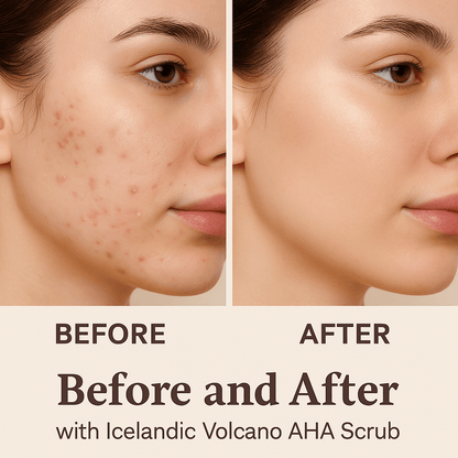 Icelandic Volcano AHA Face & Body Scrub | Luxury Clean Beauty by REK Cosmetics